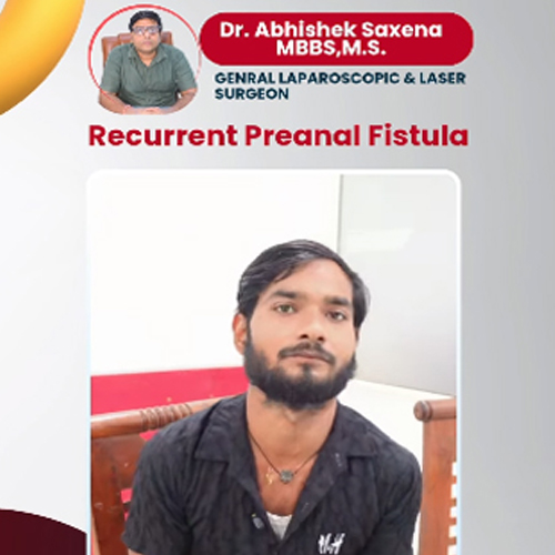 Advanced-Laser-Surgery-for-Fistula1-thumbnail