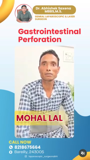 Gastrointestinal-Perforation-Repair