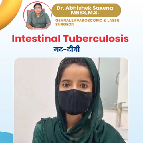 Intestinal-Tuberculosis-Management-thumbnail