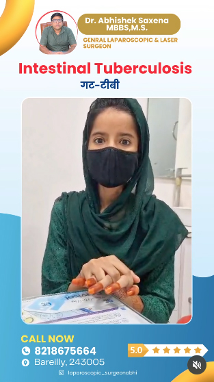 Intestinal-Tuberculosis-Management